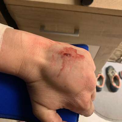 Welche Verletzungen habt ihr durch euren Hund erlitten?-Beitrag-Bild