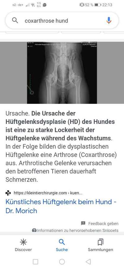 Goldakupunktur Erfahrung-Beitrag-Bild