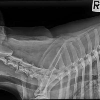 Starke Schmerzen nach dem Spazierengehen / Bandscheibenvorfall-Beitrag-Bild