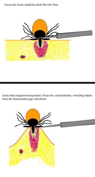 Zecken richtig entfernen-Beitrag-Bild