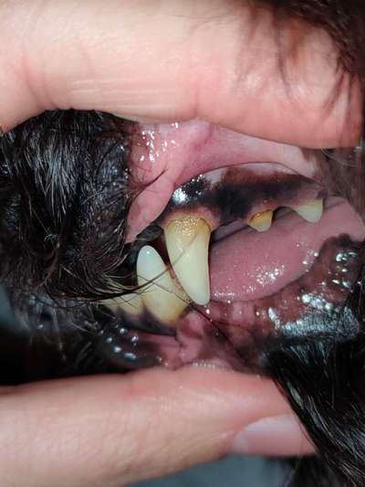 Zahnstein selbst entfernen - Zahnsteinentferner-Beitrag-Bild