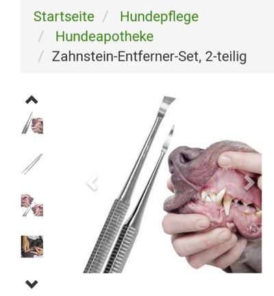 Zahnstein-Beitrag-Bild