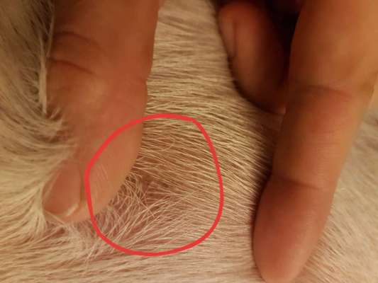 Hautkrebs oder Muttermal?-Beitrag-Bild