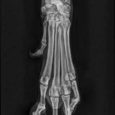 Knochenhautentzündung-Beitrag-Bild