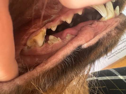 Graue Zahnverfärbung-Beitrag-Bild