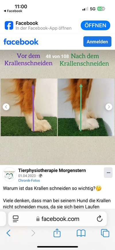 Gangbild/-analyse-Beitrag-Bild