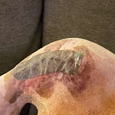 Kreuzband OP-Beitrag-Bild