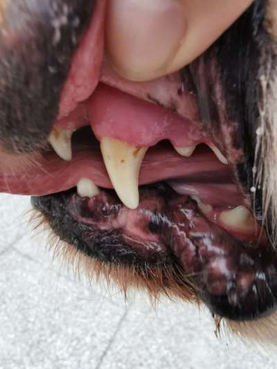 Zahnstein entfernen-Beitrag-Bild