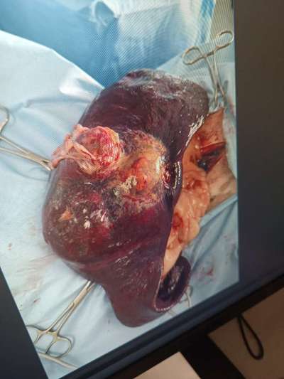 Operation ja oder nein? Tumor entdeckt-Beitrag-Bild