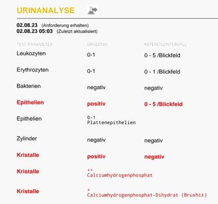 Calciumhydrogenphosphat Kristalle-Beitrag-Bild