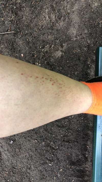 ⚠️🐛 Eichenprozessionsspinner – echte Gefahr für Hunde oder unnötige Panikmache?-Beitrag-Bild