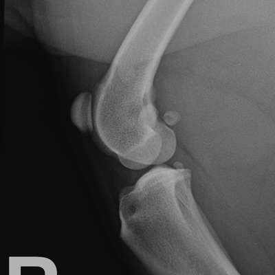 Kreuzband OP-Beitrag-Bild
