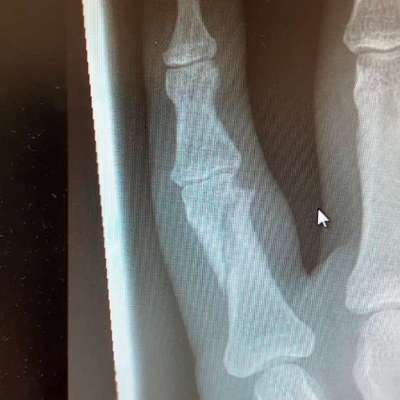 Welche Verletzungen habt ihr durch euren Hund erlitten?-Beitrag-Bild