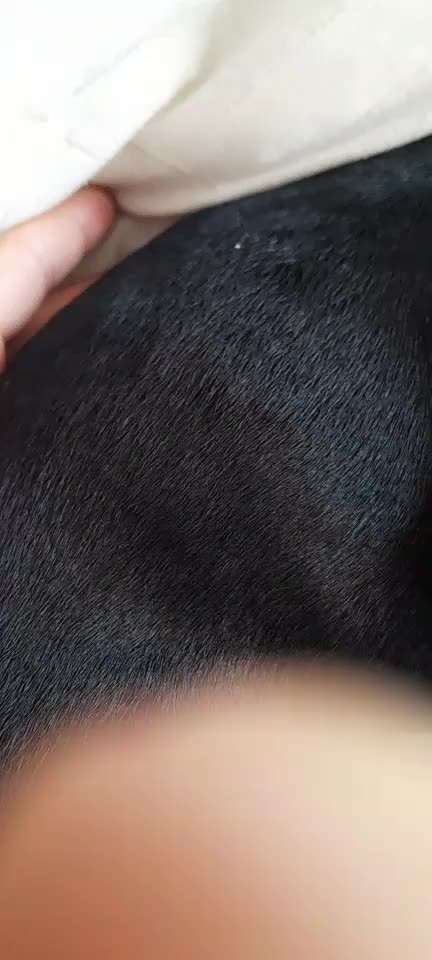 Pickel am ganzen Körper-Beitrag-Bild