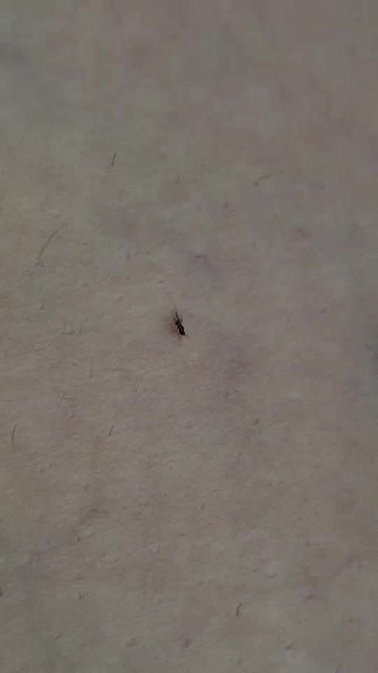 Fliegen am Kopf-Beitrag-Bild