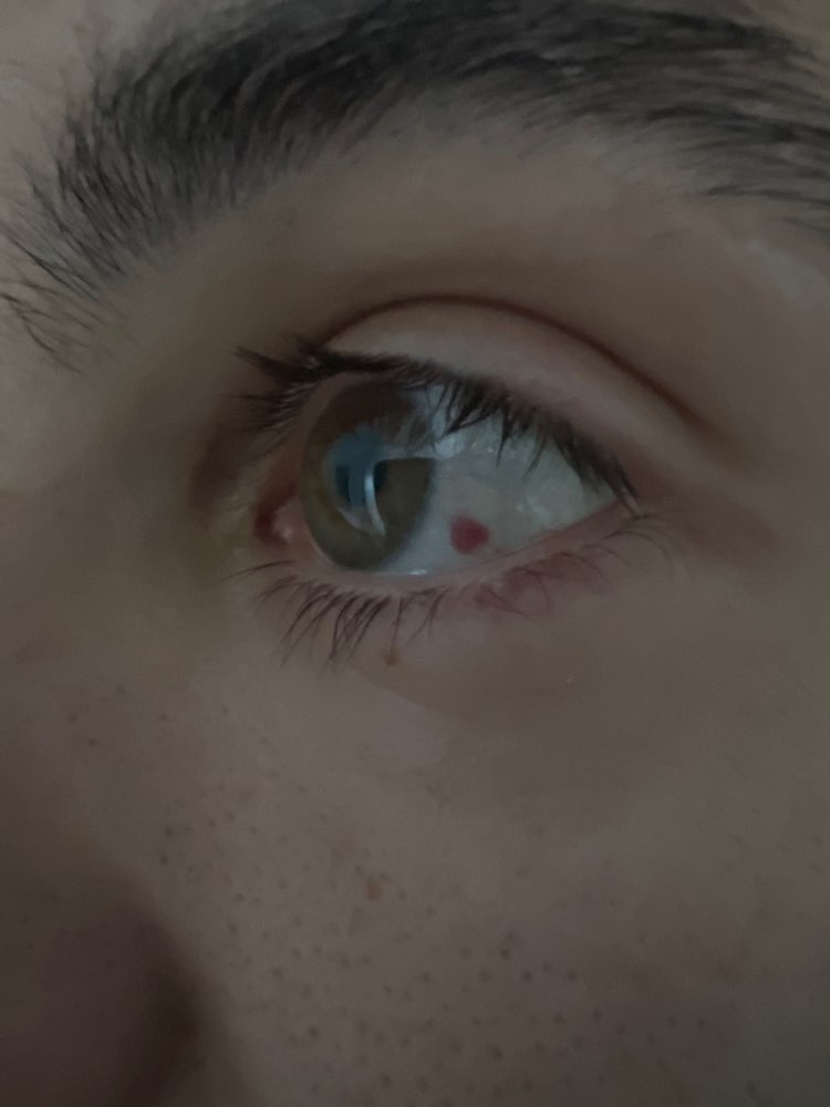 Giftköder-Gewaltätiger Angriff durch Hundebesitzer-Profilbild