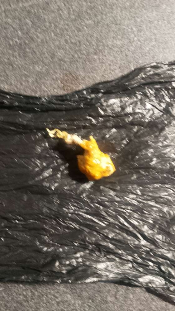 Giftköder-Giftköder, Achtung-Profilbild