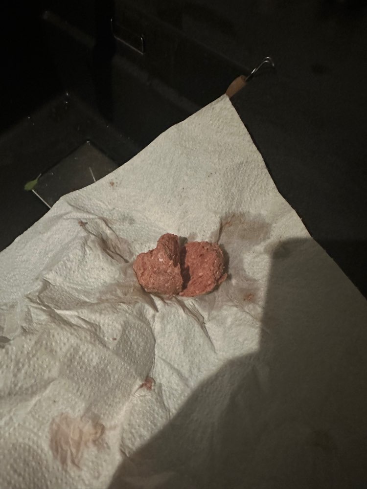 Giftköder-Hackball in unserem Garten gefunden-Profilbild