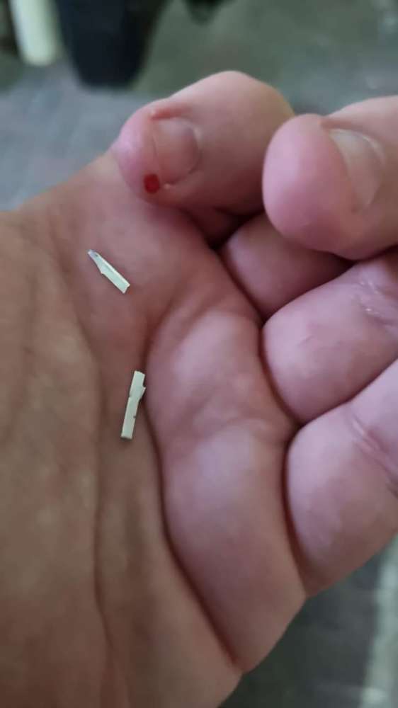 Giftköder-Würste mit Rasierklingen-Profilbild