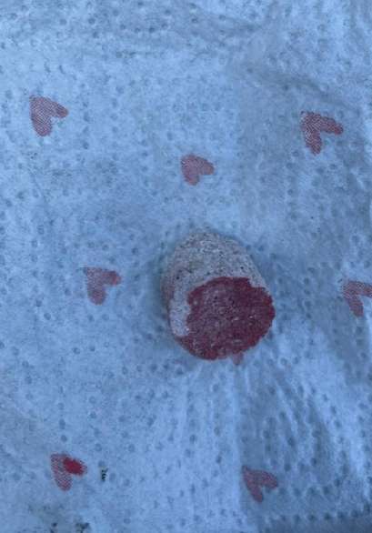 Giftköder-Hund soll Giftköder gefressen haben-Profilbild