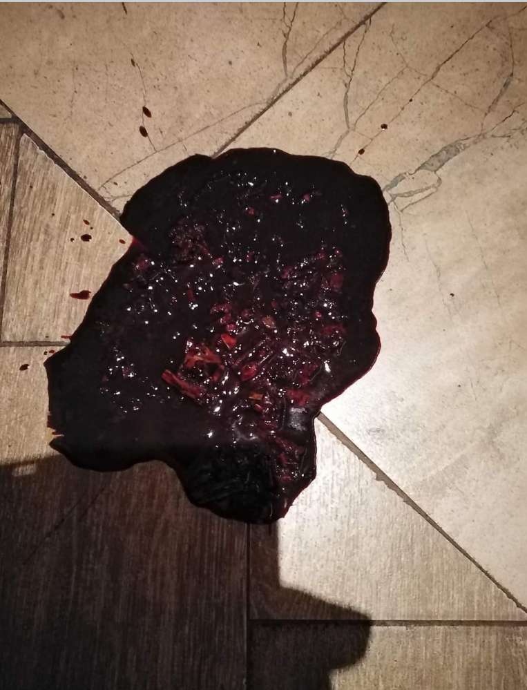 Giftköder-Stadtrandsiedlung Malchow vorsicht Gift-Profilbild