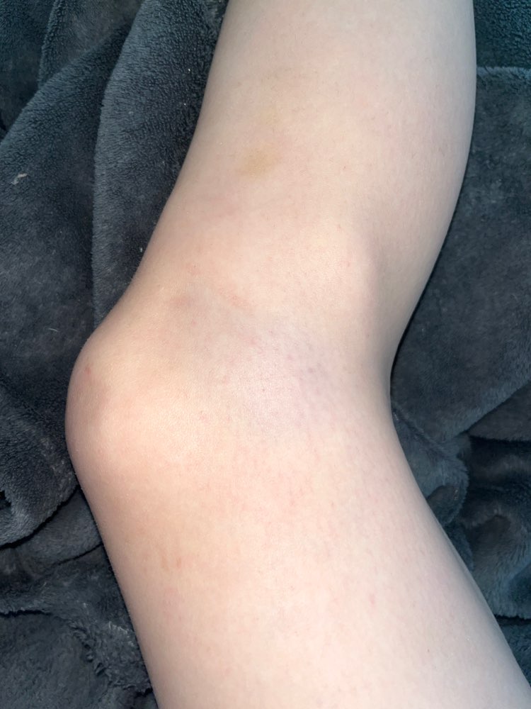 Giftköder-Frauenschläger-Profilbild