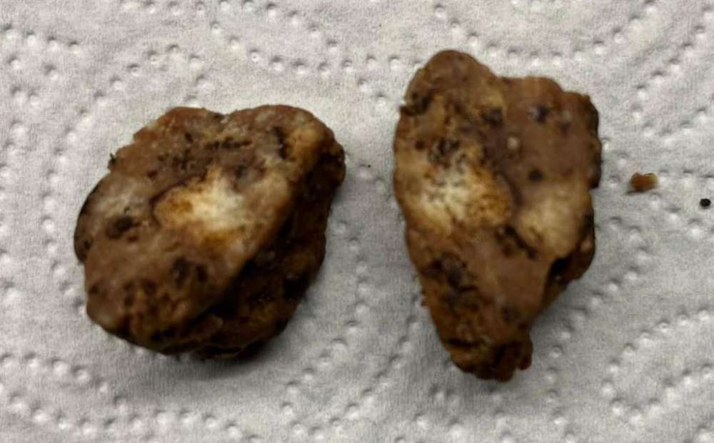 Giftköder-Giftköder-Profilbild