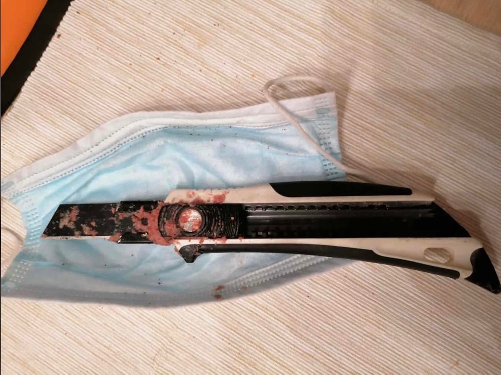 Giftköder-Teppichmesser mit Hundefutter beschmiert-Profilbild