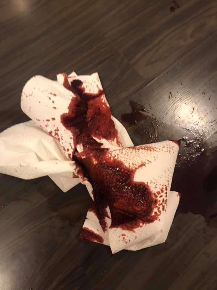 Giftköder-Vergifteter Hund-Profilbild