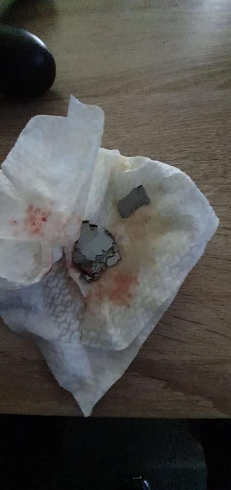 Giftköder-Rasierklingen in Fleisch-Profilbild
