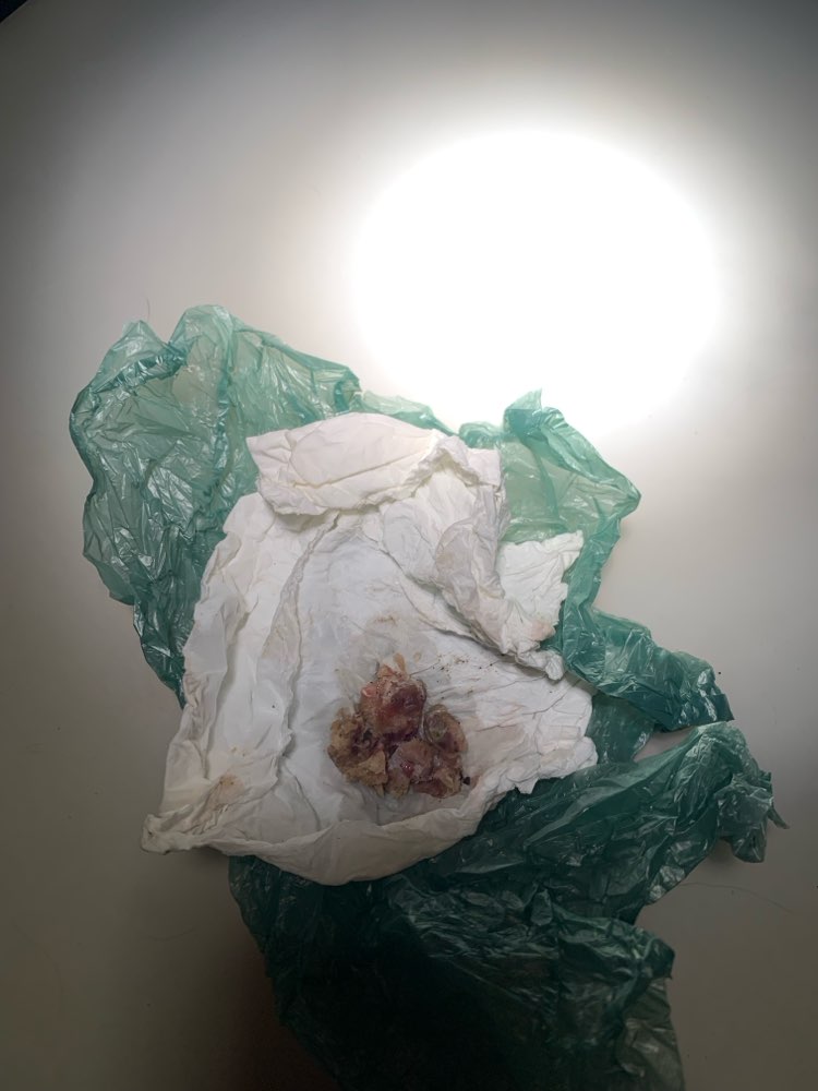 Giftköder-Speckwürfel ausgelegt-Profilbild